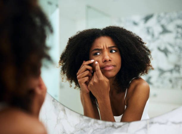 Shot of an attractive young woman squeezing a pimple on her face at home